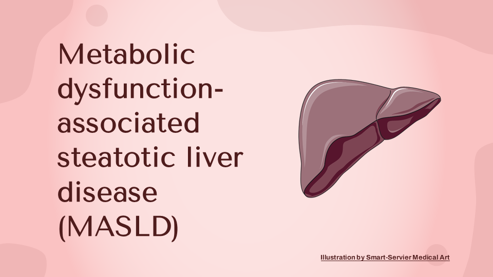 Σχετιζόμενη με μεταβολική δυσλειτουργία στεατωτική νόσος του ήπατος (metabolic dysfunction-associated steatotic liver disease, MASLD) open013